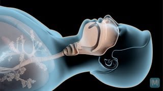 Sleep Apnea verses Snoring  Match Health [upl. by Silenay]