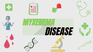 Myxedema Definition Symptoms Diagnosis Treatment [upl. by Eimmak]