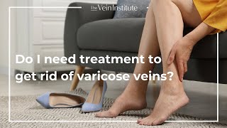 Treatment vs AtHome Care for Varicose Veins [upl. by Aciretehs319]