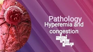 Hyperemia and congestionpathoL14 part 1 [upl. by Jobey492]