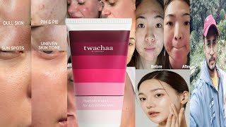 Twachaa Peel Off Mask  Honest Review [upl. by Ardin534]