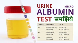 Micro Albumin Urine Test Procedure Results Analysis and Normal Range in Hindi [upl. by Nowell264]