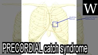 PRECORDIAL catch syndrome  WikiVidi Documentary [upl. by Dorothy]