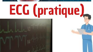 shortsvideo shorts shortvideo ECG pratique [upl. by Renae]