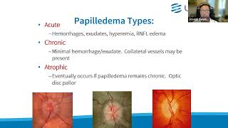 Clinical Grand Rounds in Optic Neuropathies “You’ve Got Some Nerves” [upl. by Everara]