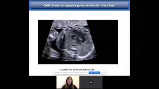 Généralités sur le coeur foetal  Webinaire de formation en échographie [upl. by Forest]