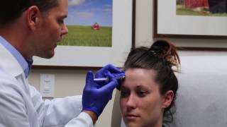 Botox For Migraines [upl. by Alacim]