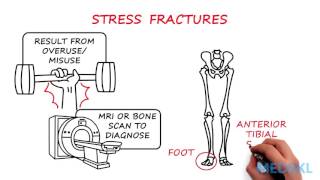 Orthopedics  Bone or Joint Injury By Shalini Ramasunder MD [upl. by Tharp365]