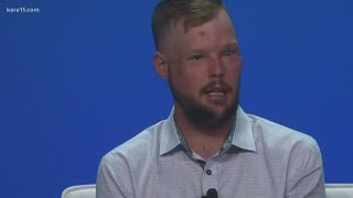 Mayo Clinics first facial transplant recipient speaks about mental health [upl. by Sidnala47]