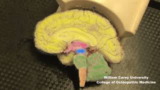 Embryologic subdivisions of the brain traditional view not the prosomeric model neuroanatomy [upl. by Madelle]