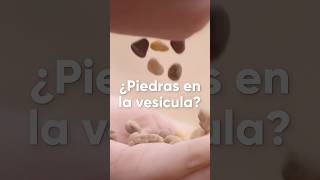 ¿Piedras en la vesícula [upl. by Ahsima31]