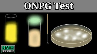 ONPG Test  Betagalactosidase ONPG Activity Assay [upl. by Perlman]