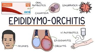 EpididymoOrchitis  epididymis [upl. by Hailey]