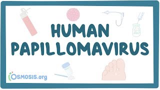 Human papillomavirus or HPV [upl. by Areht402]