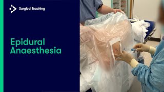 Epidural Anaesthesia What is it and How Do We Perform it [upl. by Hamlin]