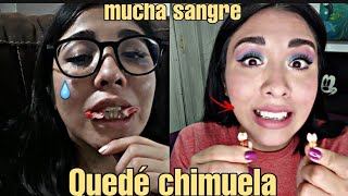 Mi extracción de premolares Quede chimuela🦷 [upl. by Koffman45]