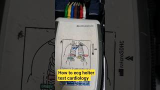 how to ecg holter test 24 house bsc cardiologist  viralvideo viral like heartcentercard [upl. by Balough]