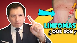 ¡ALERTA ¿QUÉ SON LOS LINFOMAS ¿TODO GANGLIO AUMENTADO DE TAMAÑO ES UN POSIBLE LINFOMA [upl. by Gemperle]