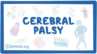 Cerebral palsy CP  causes symptoms diagnosis treatment pathology [upl. by Atsedom]