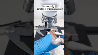 Insects Under A Microscope thistechnology funny mrbeast shoets facts microscope shortsfeed [upl. by Aridnere]