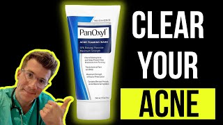 Doctor explains how to use BENZOYL PEROXIDE for ACNE aka PanOxyl  Acnecide  Side effects amp more [upl. by Chap]