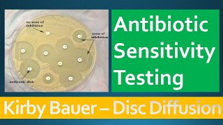 Kirby Bauer  Disc Diffusion Method for Antibiotic Susceptibility Testing [upl. by Timon]