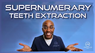 Tips On How To Perform Supernumerary Teeth Extraction [upl. by Annadroj627]