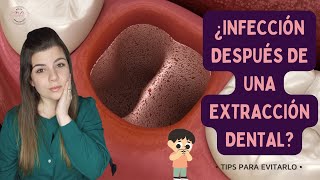 COMO SABER SI SE ME INFECTÓ UNA EXTRACCIÓN DE MUELA 😱🦷  tips para PREVENIRLO en 2023 ✅ [upl. by Ntsyrk454]