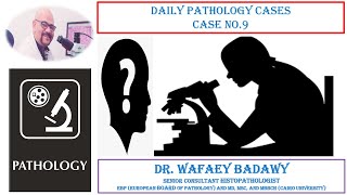 DAILY PATHOLOGY CASES CASE NO 9 Dr WAFAEY BADAWY [upl. by Linkoski286]