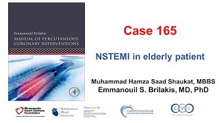 Case 165 Manual of PCI  NSTEMI in an elderly patient [upl. by Yrek]