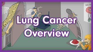 Lung Cancer Overview  USMLE Step 1 Mnemonic [upl. by Samson]