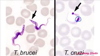 TRYPANOSOMA CRUZI [upl. by Ferdy]