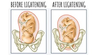 When Labor Will Start if Youre 1 Centimeter Dilated  How to Check a Cervix for Dilation [upl. by Munn647]