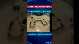 See the making of Zirconia CadCam Zirconia crown zirconia dentalcrowns [upl. by Hanafee457]