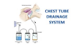 Managing CHEST TUBE DRAINAGE SYSTEM [upl. by Ardua184]