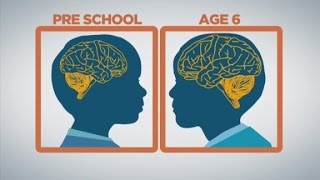 How baby brains develop [upl. by Lansing]