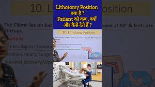 Lithotomy Position क्या है  Patient को कब क्यों और कैसे देते हैं reels medicalstudent shorts [upl. by Oidacra]