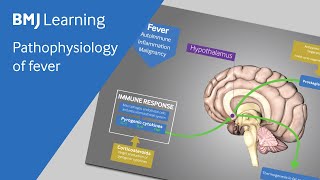 Pathophysiology of fever explained [upl. by Bender]