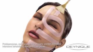 Bio Facelifting Deynique [upl. by Alduino]