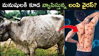 మనుషులకి కూడ వ్యాపిస్తున్న లంపి వైరస్Lumpy Virus In CowsLumpy Skin Disease In Telugu [upl. by Bertie682]