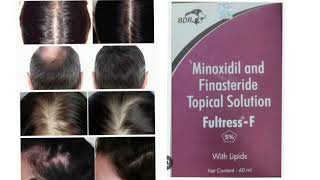 Fultress F Topical Solution Minoxidil and Finasteride Topical Solution [upl. by Leinto]