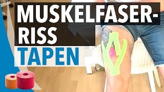 Muskelfaserriss Tapen Anleitung  Kinesiologie Tape Anleitung für Muskelfaserriss [upl. by Rabkin171]