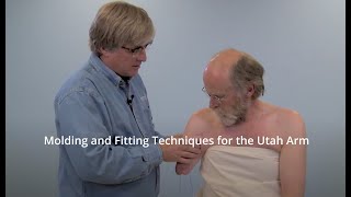 Transhumeral Molding and Fitting Techniques for the Utah Ar [upl. by Ailati]