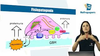 Aula Glomerulopatia Membranosa do Curso da Prova de Título Nefropapers Por Duda Vilanova [upl. by Droc]
