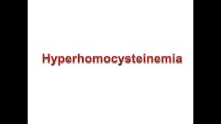 Hyperhomocysteinemia 4Oct22 24Oct22 [upl. by Eissolf487]