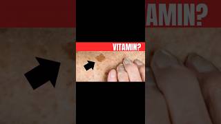 No 1 VITAMIN for removing AGE SKIN SPOTS [upl. by Bartolemo]