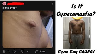 How to check Gynecomastia  Is it Gyno PART1 [upl. by Belldas35]