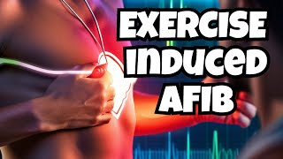 Exercise Induced AFib Expert Tips [upl. by Nitsirc]