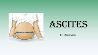 Ascites pathophysiology  liver cirrhosis CHF nephrotic syndrome exudativechylousnephrogenic [upl. by Adnoryt]