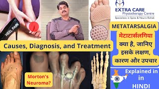 Metatarsalgia  Causes Diagnosis and Treatment  पंजों में दर्द  Mortons Neuroma  in HINDI [upl. by Constantina]